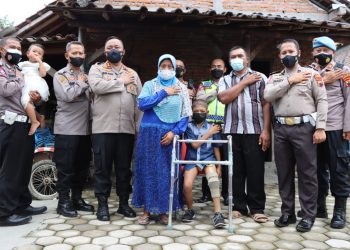 Harus Diamputasi Akibat Kanker Tulang, Kiki Kini Bisa Jalan Lagi Berkat Kaki Palsu Pemberian Kapolres Demak