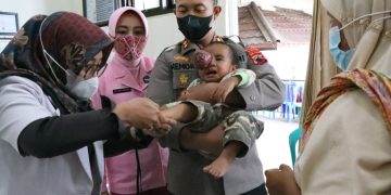 Kisah Haru Kapolres Banjarnegara Jemput Nuzailla Bocah 17 Bulan Penderita Tumor Mata Sebesar Bola Tenis